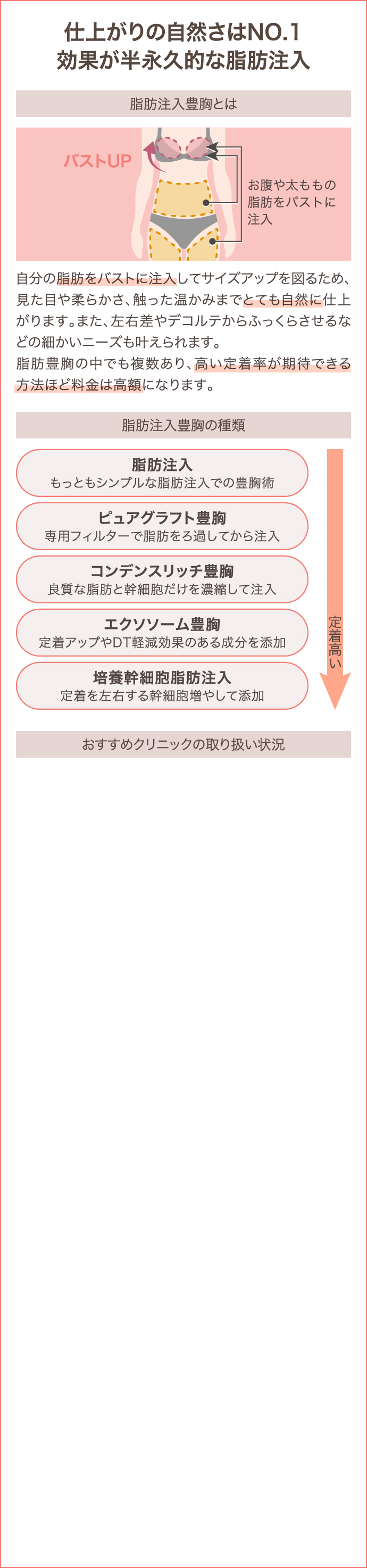 脂肪注入 詳細